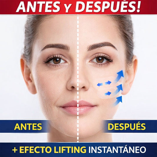 Lifting facial instantáneo – 60 parches para rostro y cuello. Ashwell+™